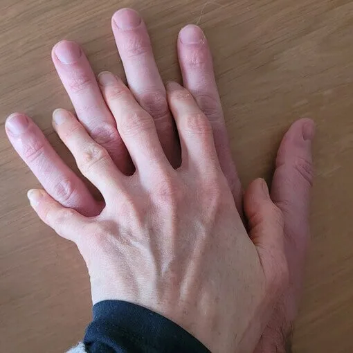 Hoe belangrijk is aanraking?